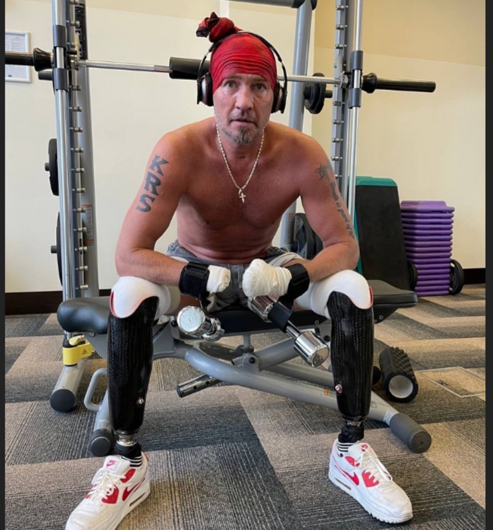 Инвалид. Протез руки. Фигуристу ампутировали ноги. Спортивный протез. Протез ноги костомаров.