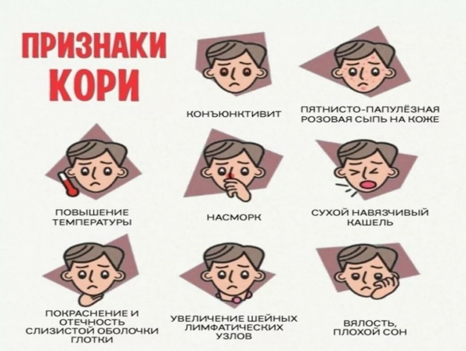 Признаки начинающих. Характерные клинические симптомы кори. Корь характерные клинические симптомы. Ори 4к.