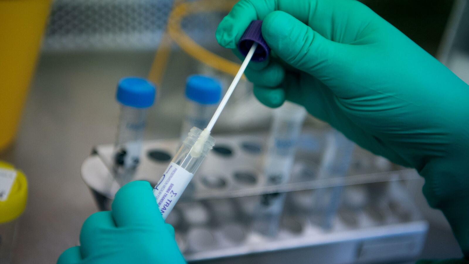 Республикала 37 меңдән ашыу кеше COVID-19 менән сирләй